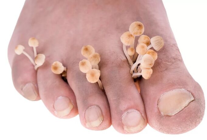 The mushroom of the feet